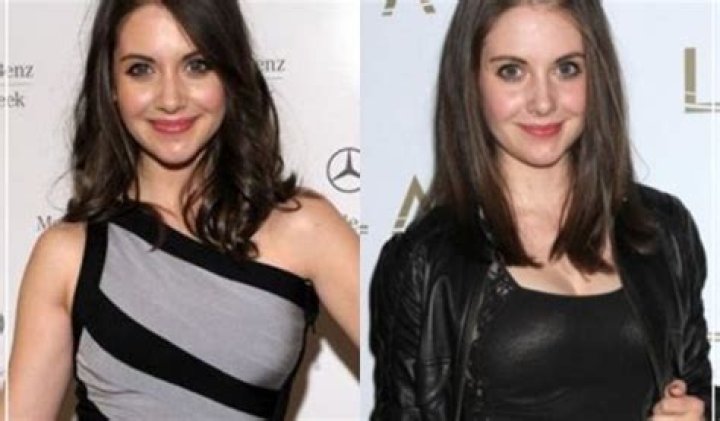 Alison Brie Plastic Surgery Before and After
