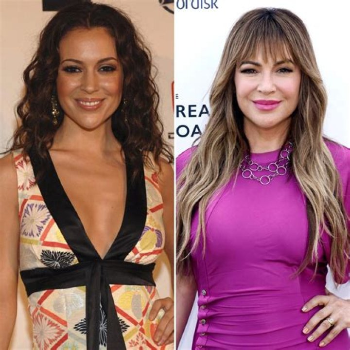 Alyssa Milano Plastic Surgery Before and After Botox Injections