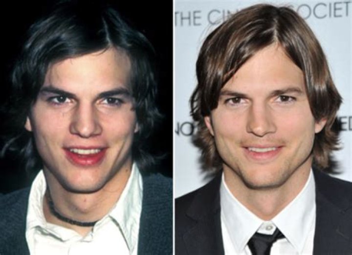 Ashton Kutcher Nose Job Plastic Surgery Before and After