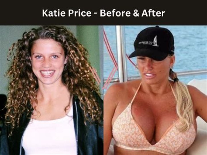 Coco Austin Breast Implants Plastic Surgery Before and After