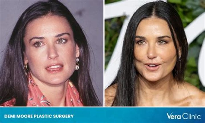 Demi Moore Plastic Surgery: Glowing Surgerically or Aging Gracefully?