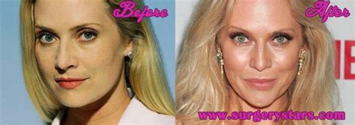 Emily Procter Plastic Surgery Before and After