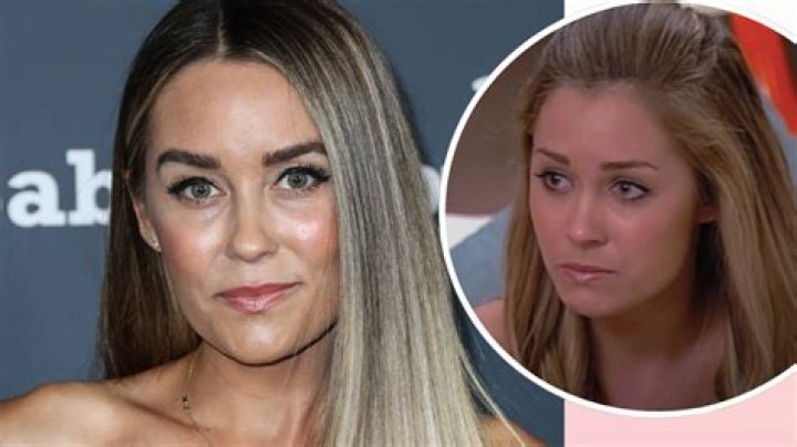 Lauren Conrad Plastic Surgery Before and After