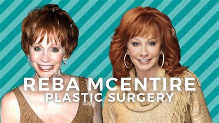 Reba McEntire Plastic Surgery: From Rumors to Reality