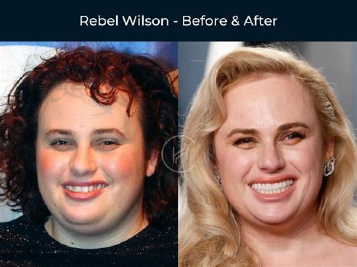 Rebel Wilson Before and After: Body Positivity Unveiled!