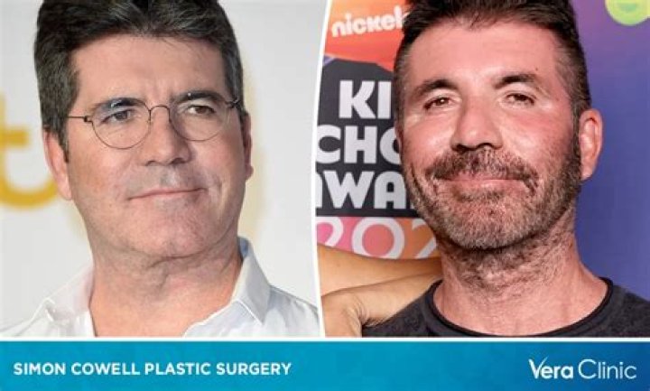 Simon Cowell Plastic Surgery: Fans Praise and Criticize the Music Mogul's Latest Look
