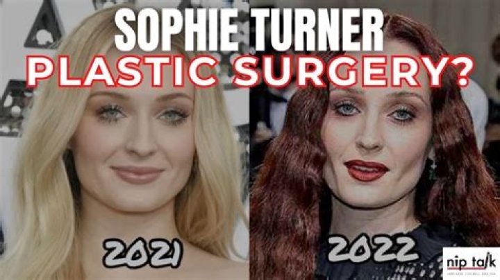 Sophie Turner Plastic Surgery: Sophie's Clear Admission or Straight Denial?