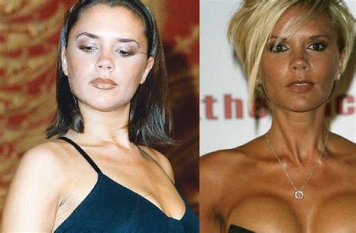 Tiffani Thiessen Breast Implants Plastic Surgery Before and After