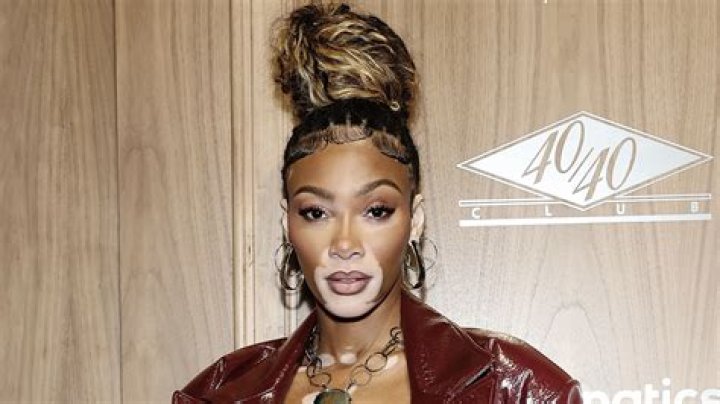 Winnie Harlow Biography - Facts, Childhood, Family Life & Achievements