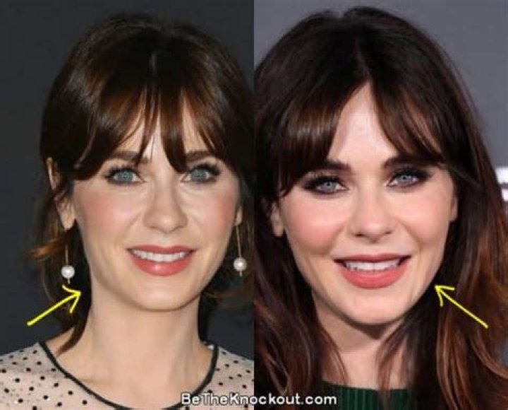 Zooey Deschanel Plastic Surgery Before and After